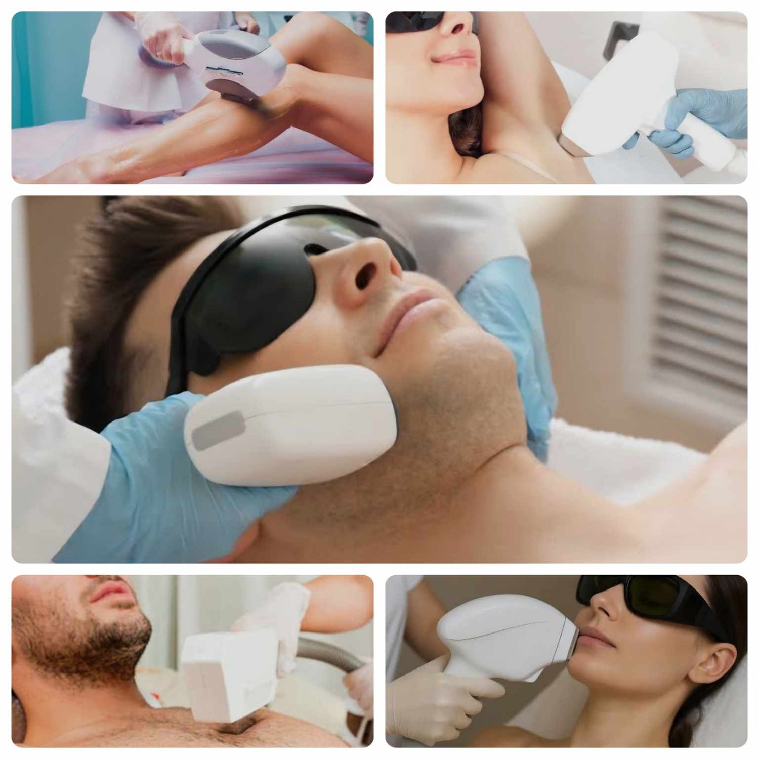 IPL (Intense Pulsed Light) Laser Hair Removal