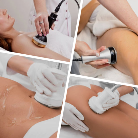 Ultrasonic Fat Cavitation