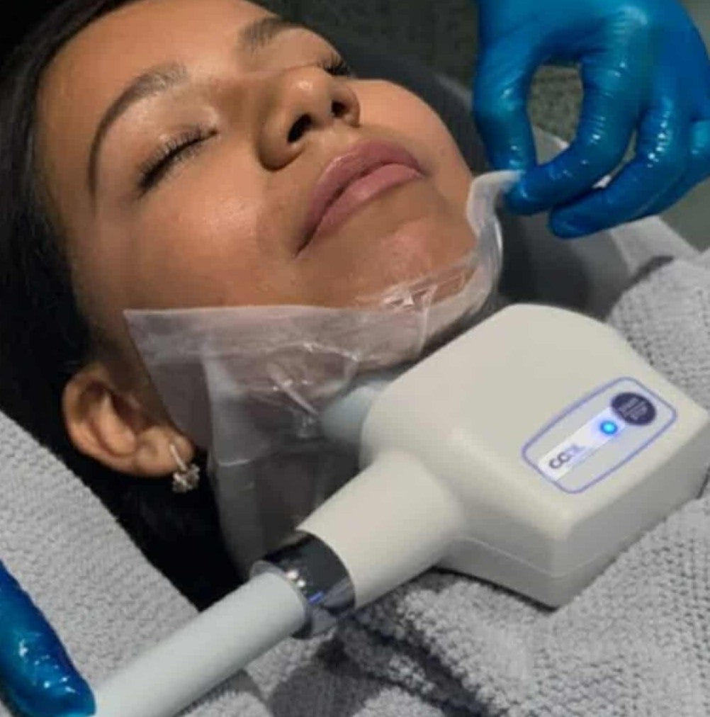 360 Slim Chin Freeze (Submental Area)