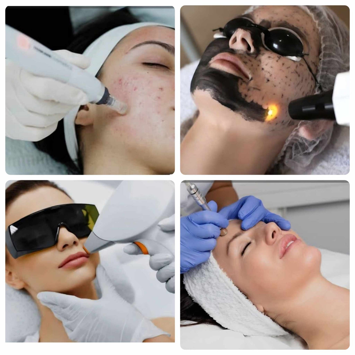 Brightening & Acne Control Protocol