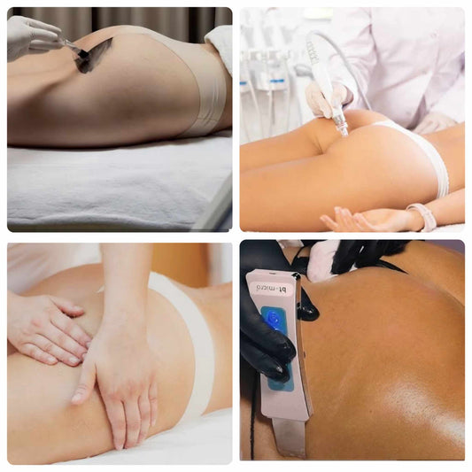 Butt Facial and Whitening Pico