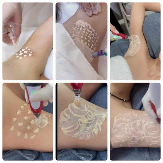 Underarm BB GLOW Whitening Treatment
