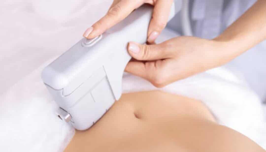 Sculpt Silhouette 22D HIFU Body Contour $2 per shot