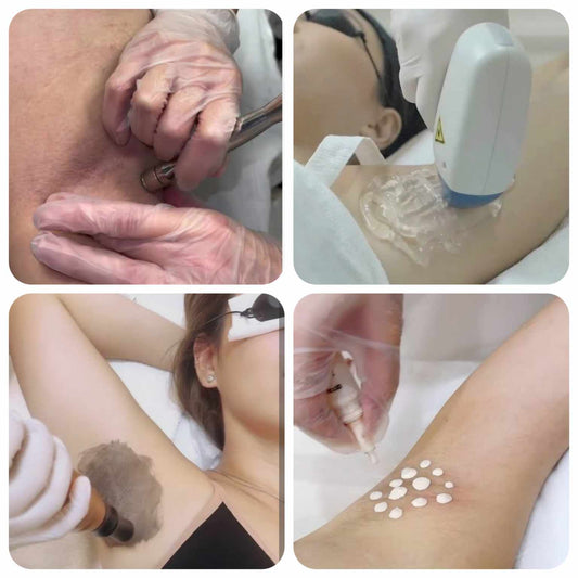 3-in-1 Underarm Whitening