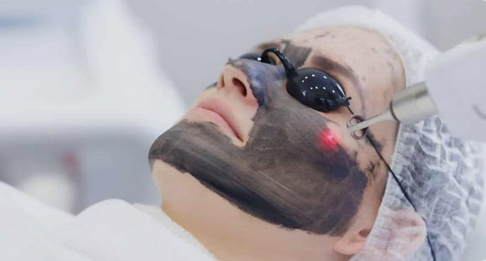 Carbon Blackdoll Facial