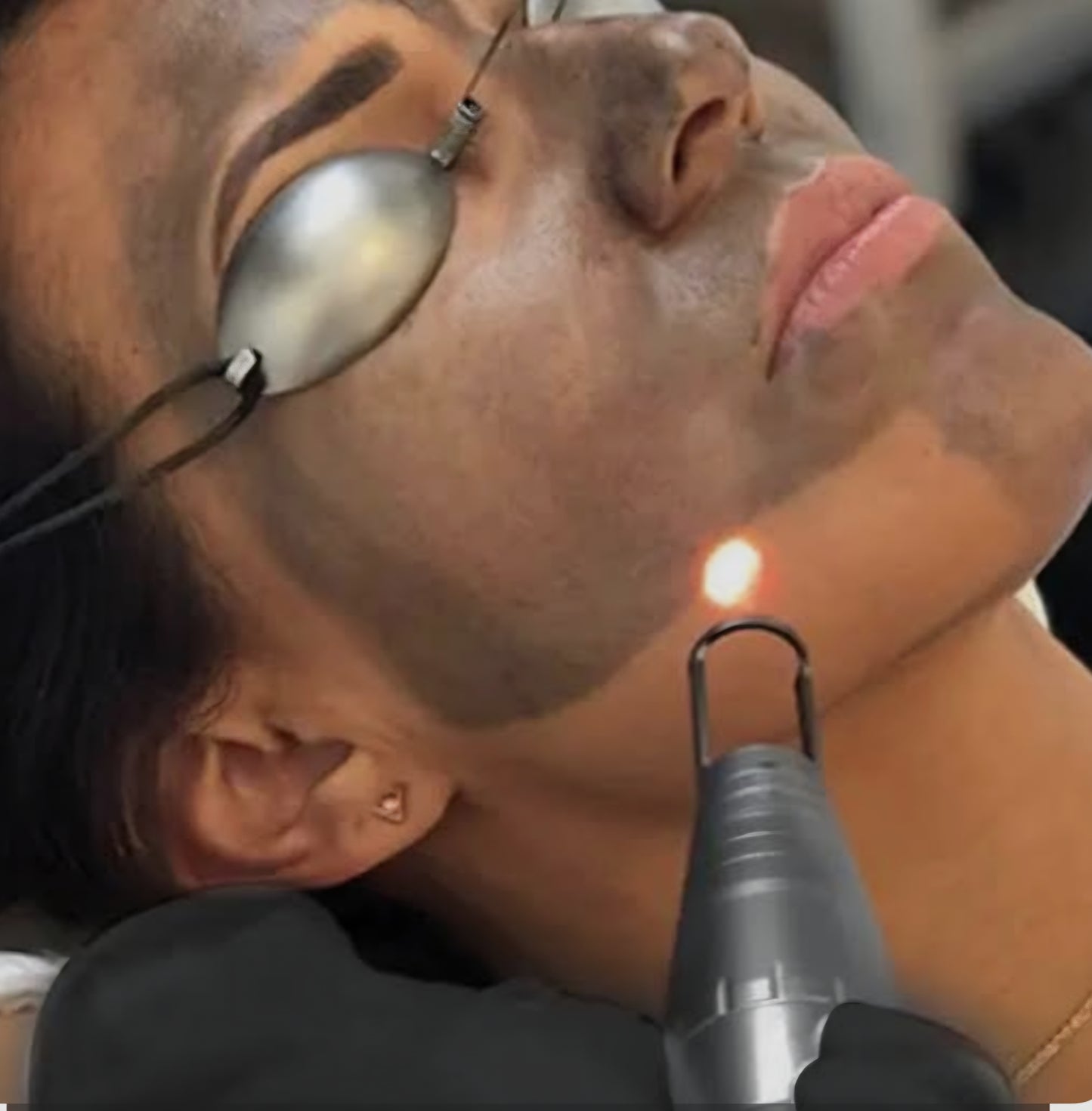 Crystal Clear Skin Rejuvenation (Pico Light – Glow & Texture)